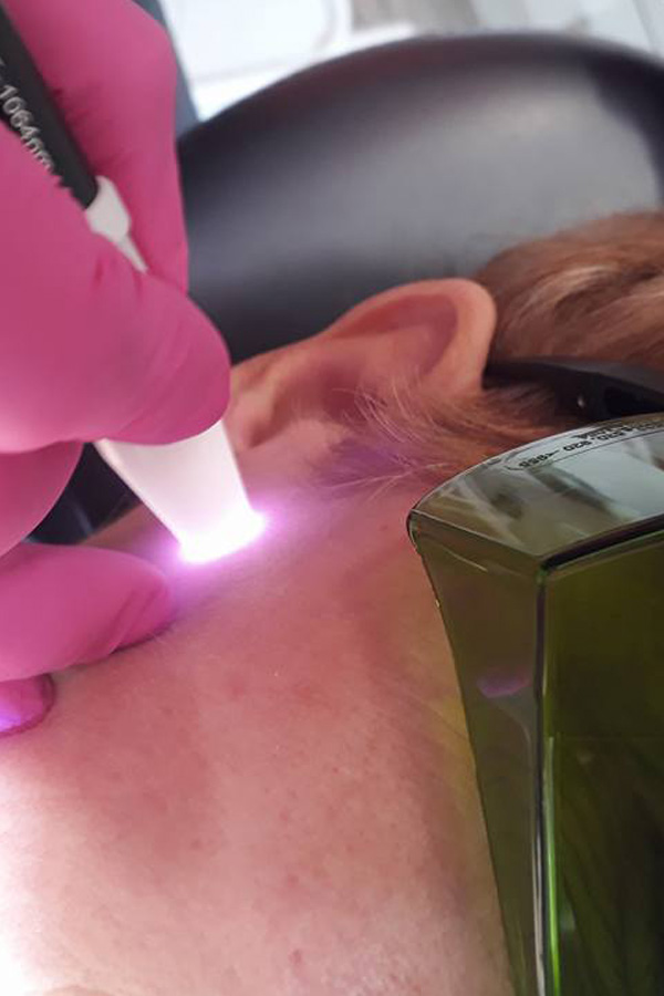 Tratamientos con láser, Clínica Dental Paula Vila